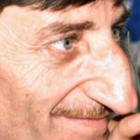 L'uomo col naso più grande al mondo
