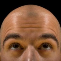 La calvizie? Tutta colpa della barba!