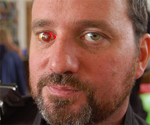 Quest'uomo si è fatto impiantare una microcamera nell'occhio